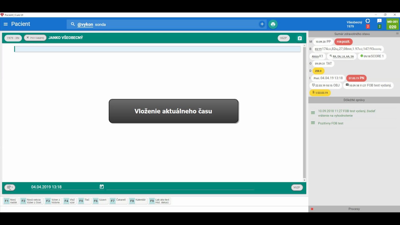 Náhľad videa Vložiť čas