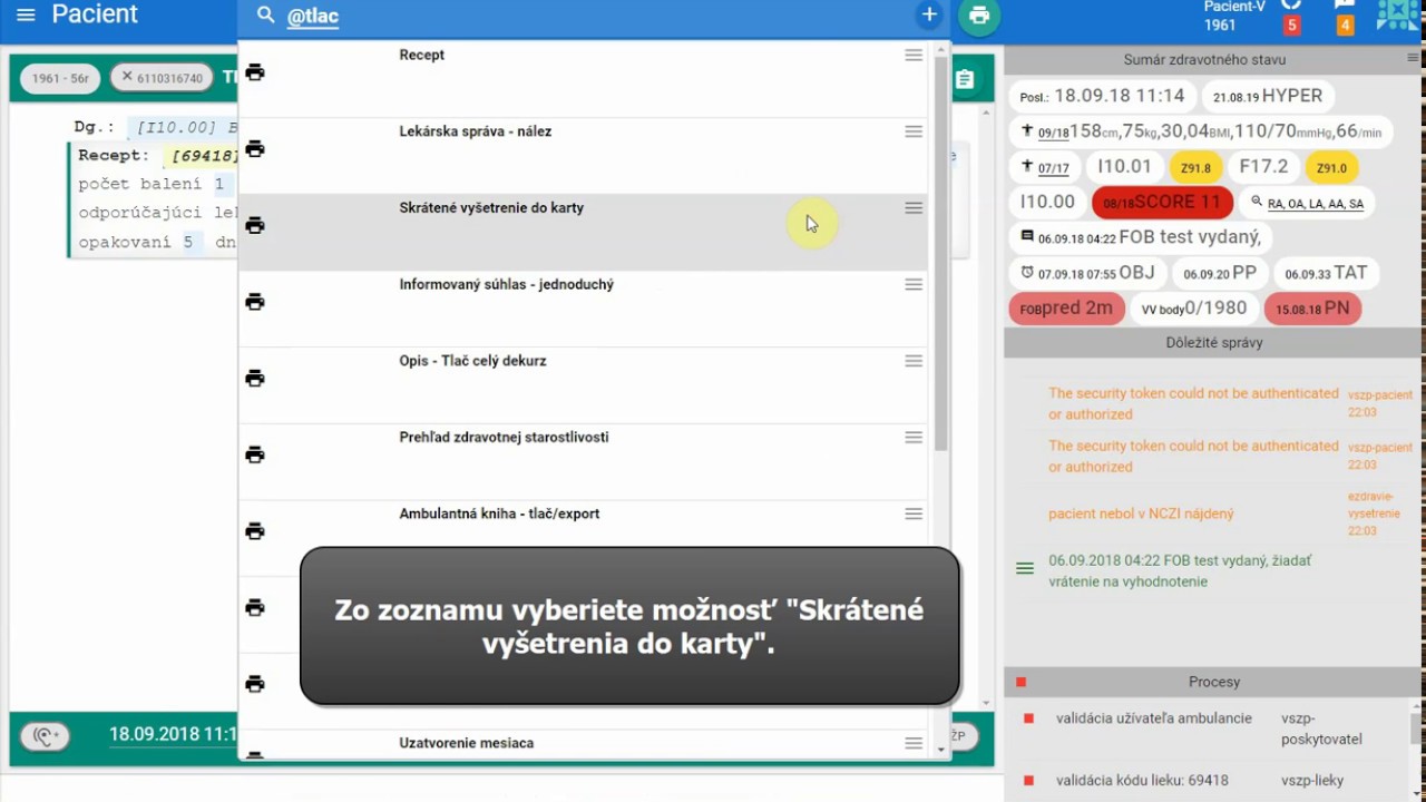 Náhľad videa Nastavenie dotlače