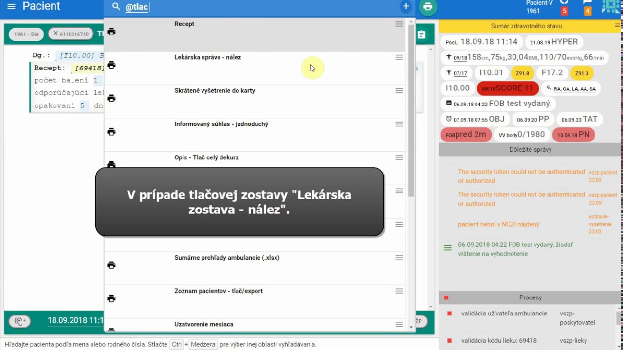 Náhľad videa Nastavenia tlače dekurzu