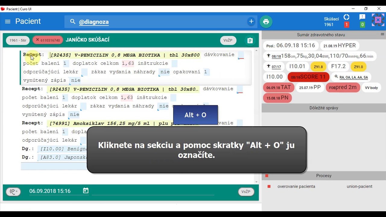 Náhľad videa Ako označovať a posúvať sekcie v rámci dekurzu