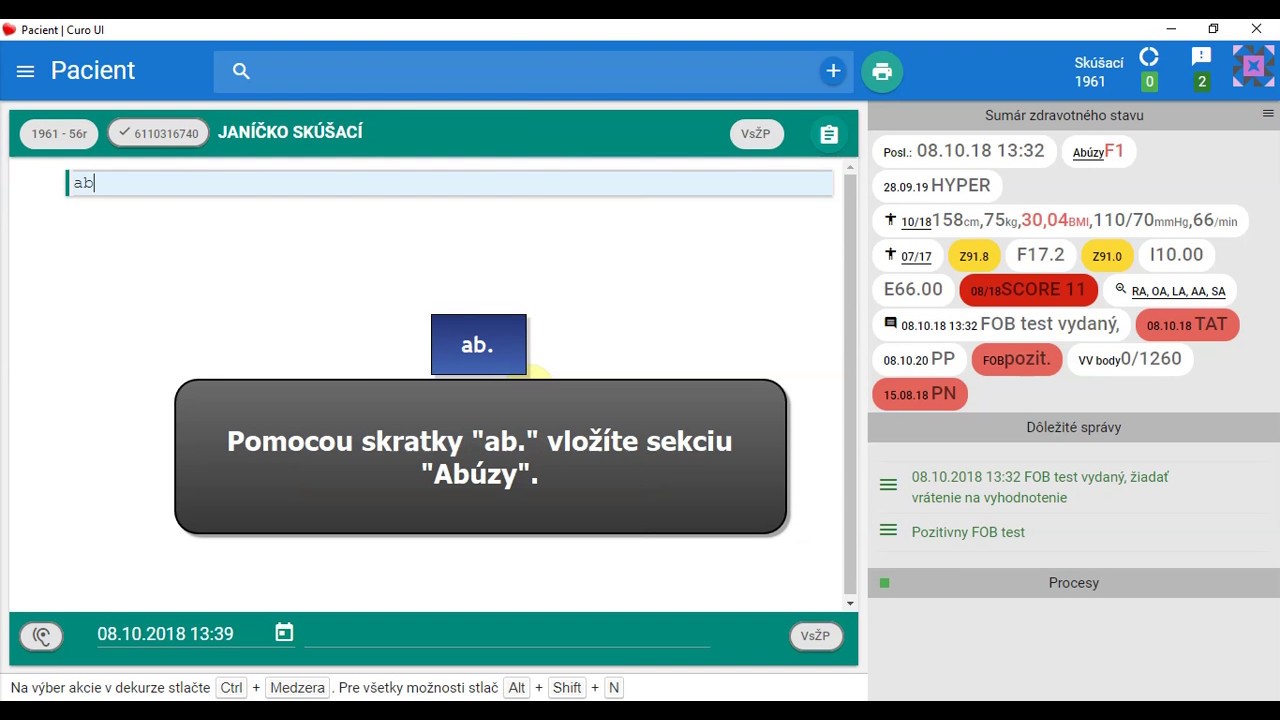 Náhľad videa Ako pracovať so sekciou Abúzy