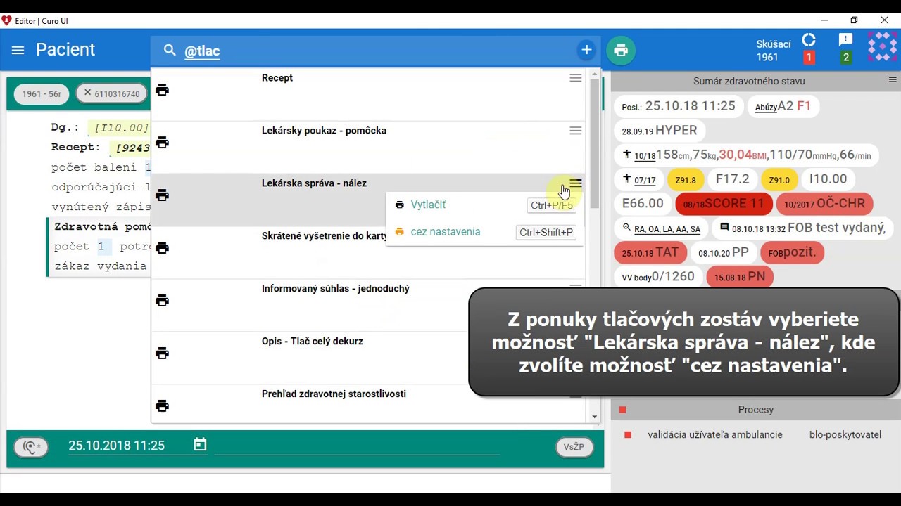 Náhľad videa Ako pri tlači lekárskeho nálezu vynechať určité sekcie