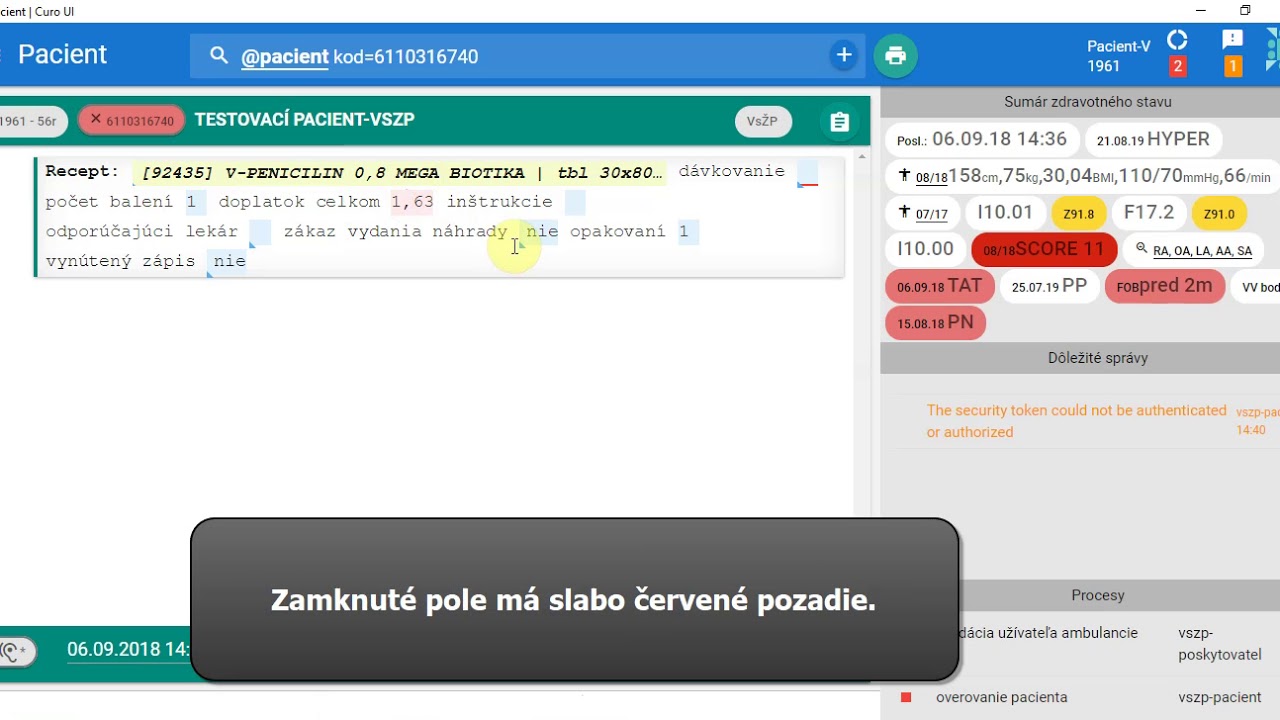 Náhľad videa Ako odomknúť / zamknúť polia