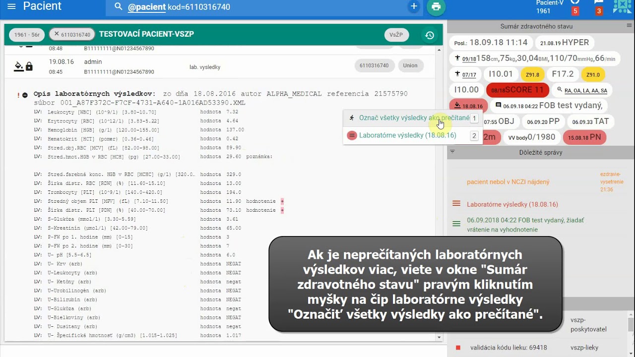 Náhľad videa Ako pracovať s laboratórnymi výsledkami
